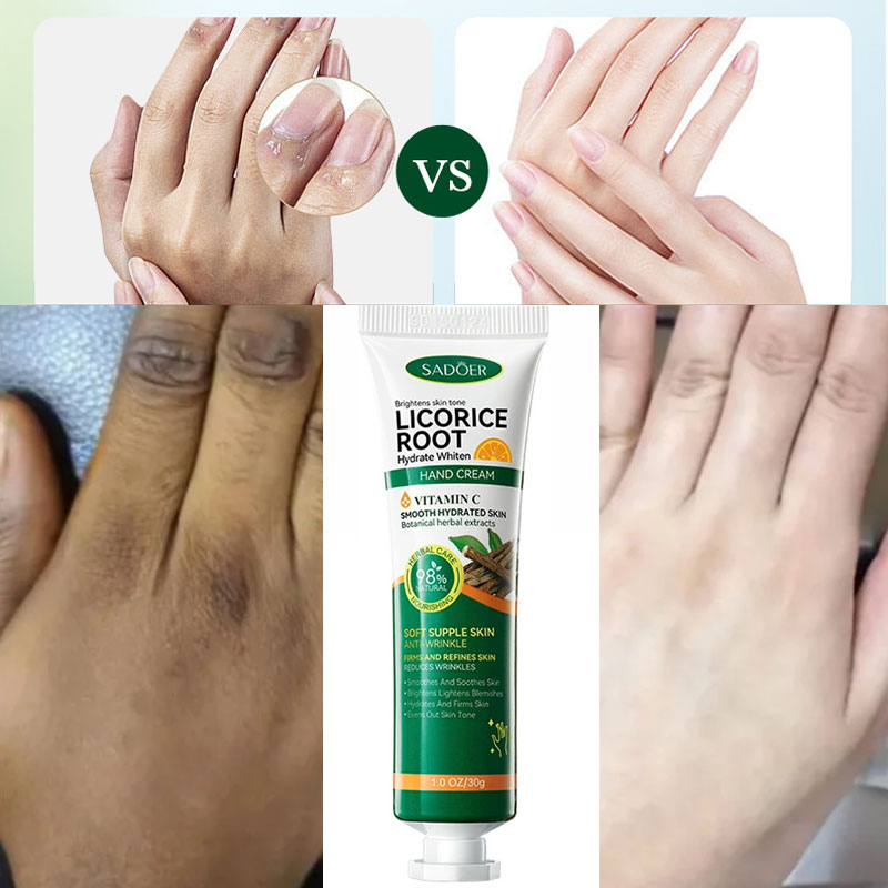 Licorice Root Extract - 高速美白ダークナックルハンドクリーム明るく保湿強力な汚れリムーバーメラニンコレクター製品ハンドスキンケア